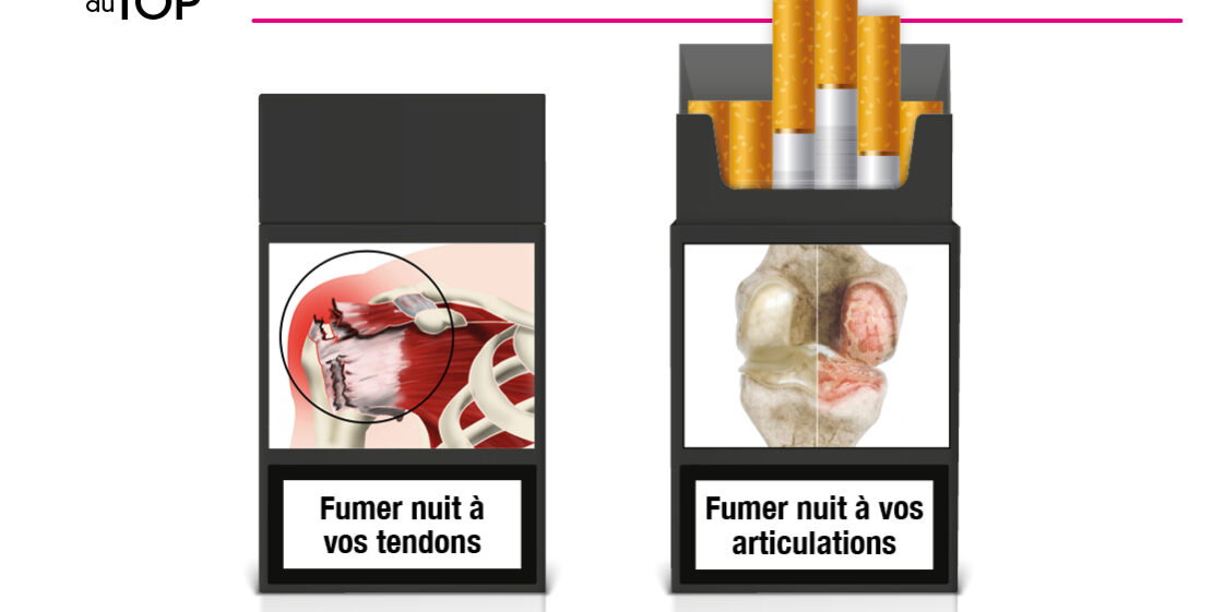 Affiche "le tabac nuit à vos tendons et vos articulations"