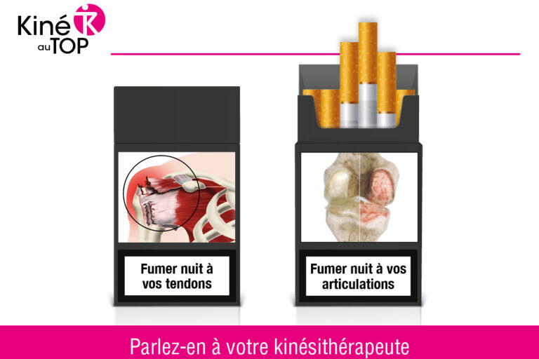 Affiche "le tabac nuit à vos tendons et vos articulations"