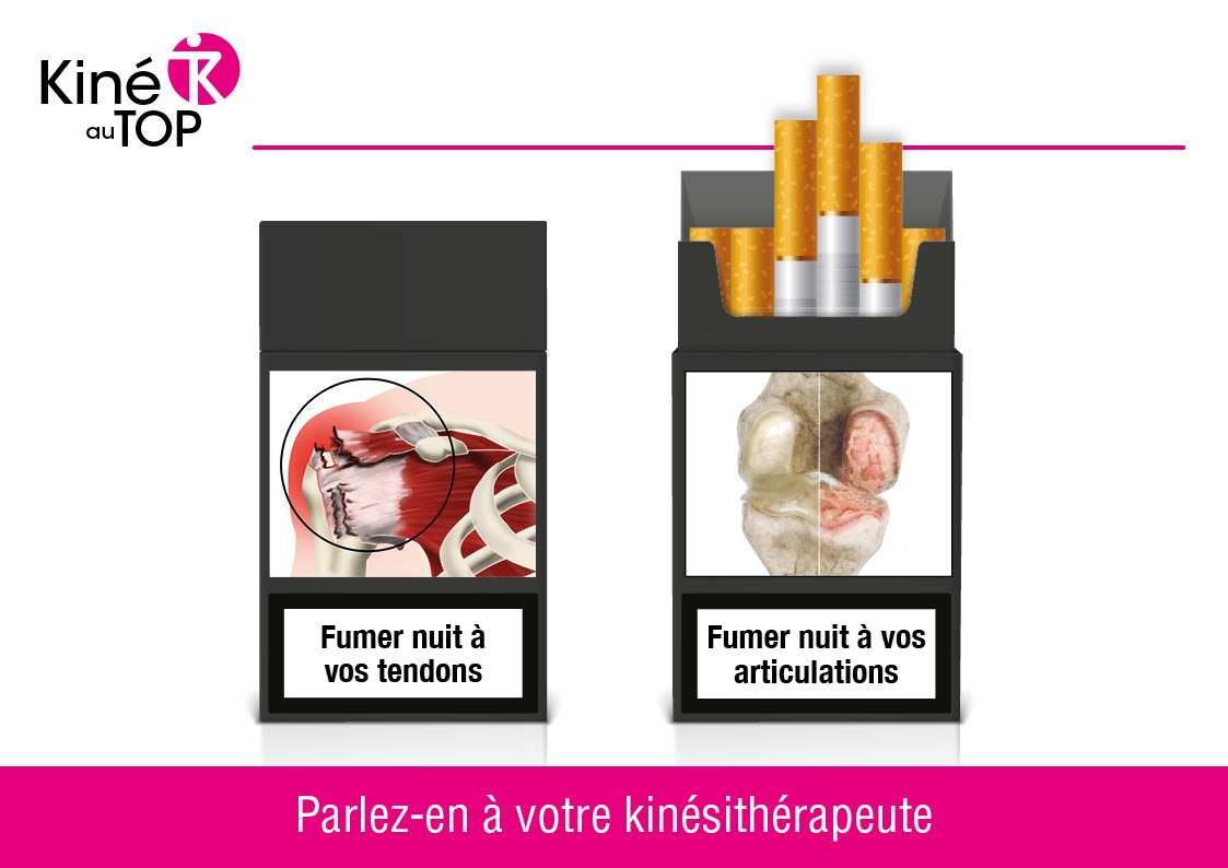 Affiche "le tabac nuit à vos tendons et vos articulations"