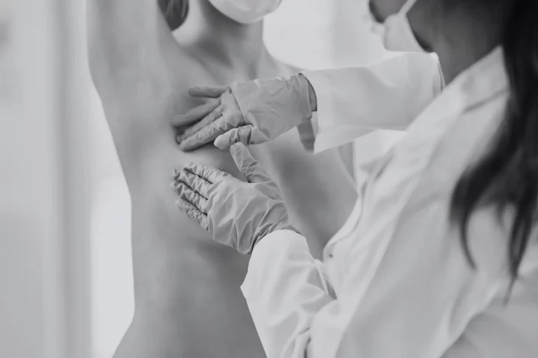 Cancer du sein : théorie et pratique sur des patientes