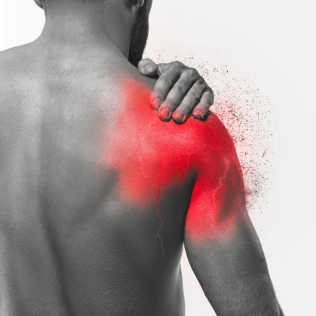 capsulite rétractile